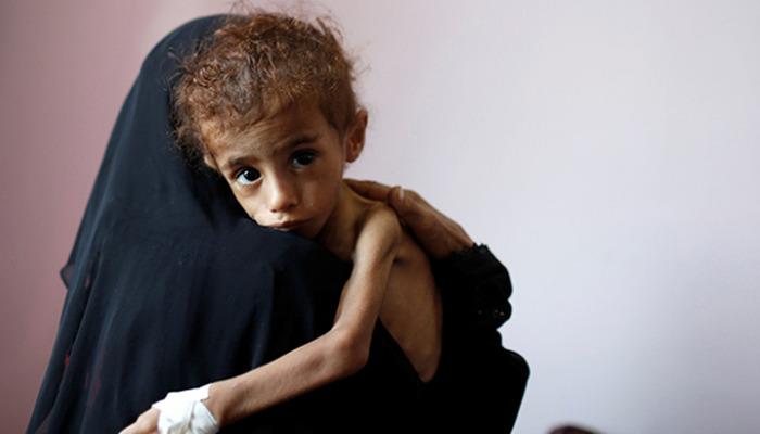 BM’ye bağlı 116 kuruluştan, yardım fonlarının yetersiz kaldığı Yemen’i kurtarma çağrısı