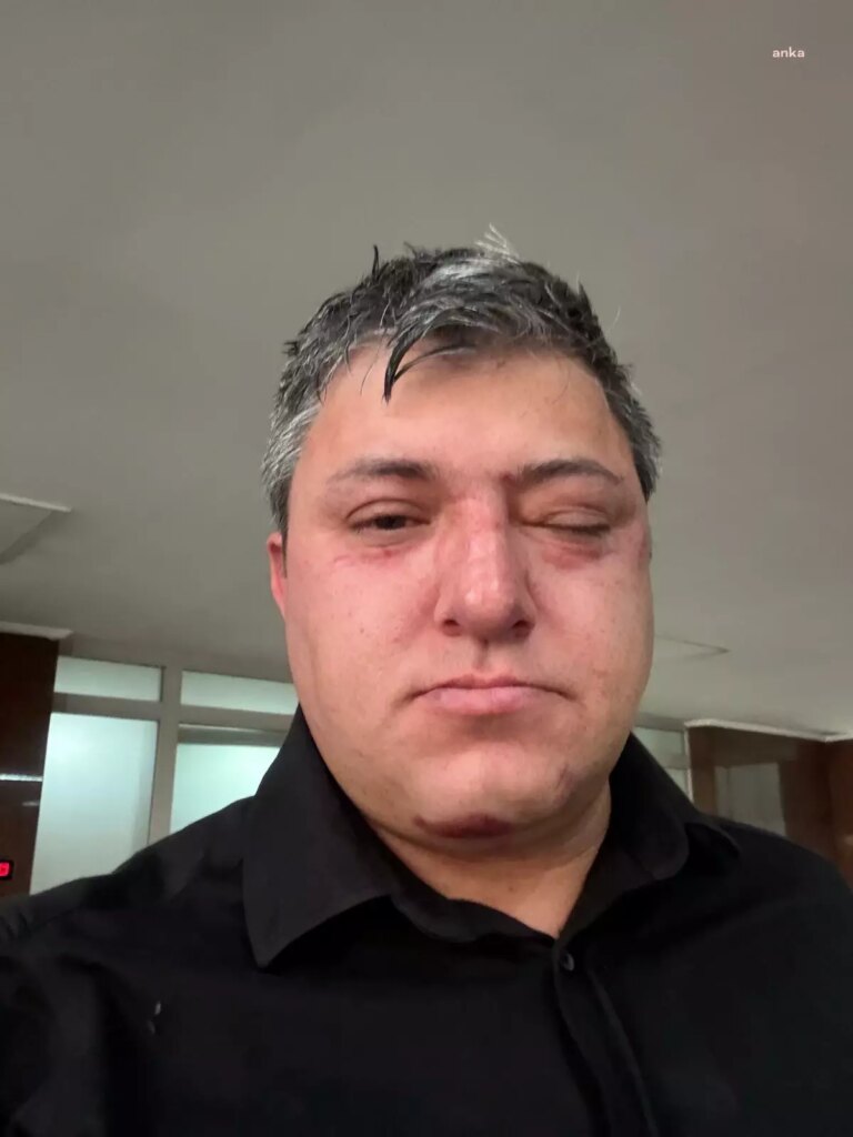 Vahim iddia: Altındağ Belediye Başkanı Tiryaki belediye işçisini darp etti