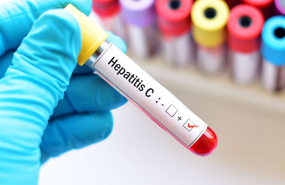 Sadece bir yılda hepatit C vakalarının sayısı %77 arttı