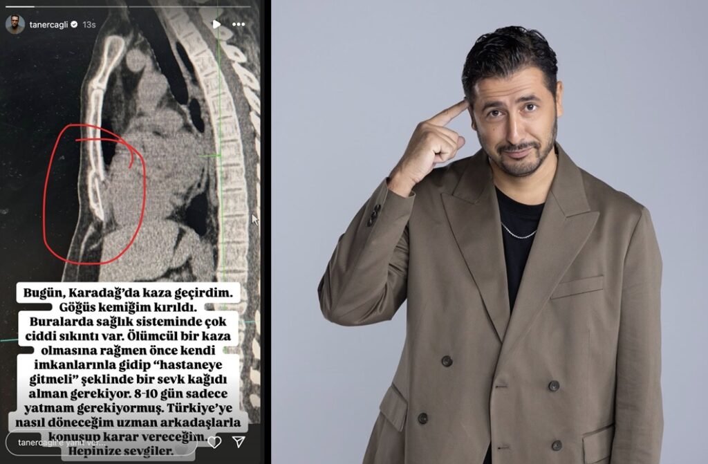 Karadağ’da Bisiklet Kazası Geçiren Taner Çağlı, Sağlık Sistemine Tepki Gösterdi – Karadağ Media