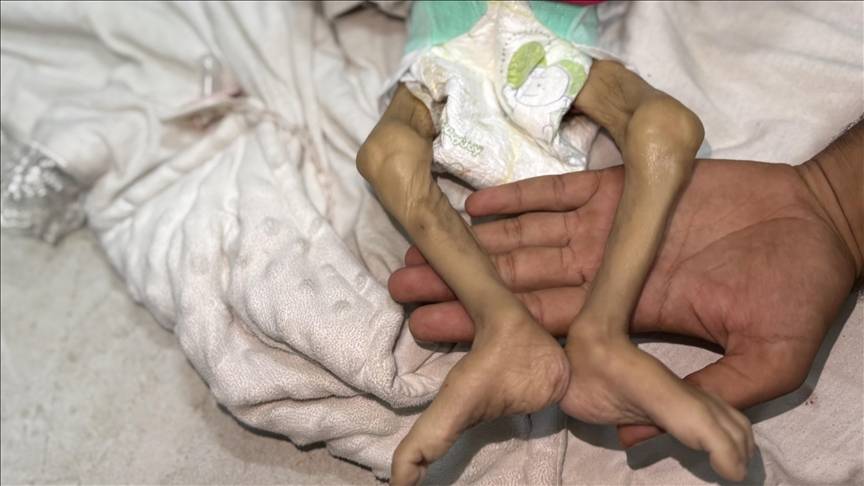 İsrail’in kıtlığı dayattığı Gazze’de bir bebek daha açlıktan can verdi