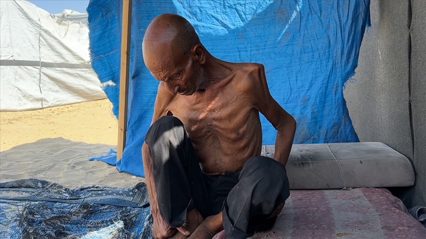 Gazze Şeridi’nde 75 yaşındaki yaşlı adam, İsrail’in dayattığı açlık nedeniyle 40 kiloya düştü