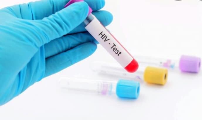 Kosova’da HIV vakaları artıyor