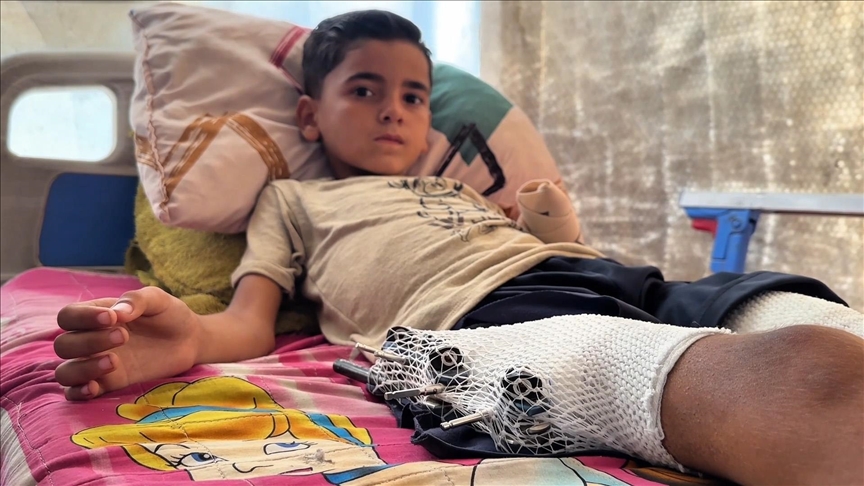 İsrail’in Gazze’de oyun oynarken hedef aldığı küçük Esed iyileşip yeniden “çocuk olmak” istiyor
